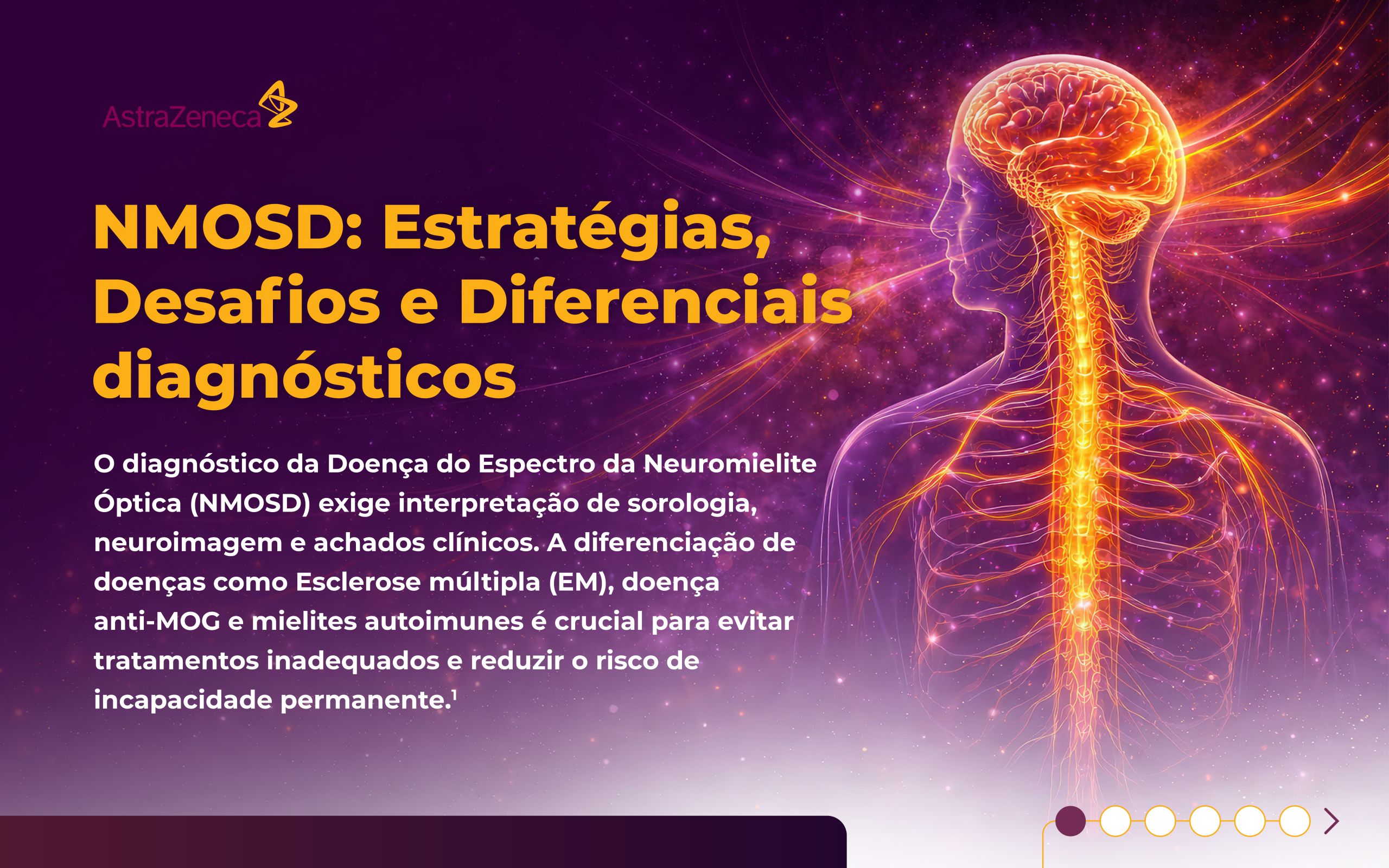 01 - 07 - AZ-Projecto_Impulsione_NMOSD_Infografia_NEUROLOGIA-1